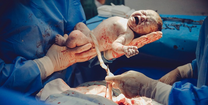 Дві одночасні операції врятували життя українки і її новонародженої дитини